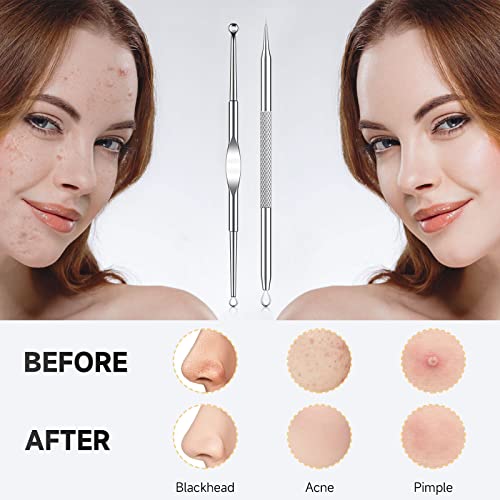 FACEMADE 7 Pcs Blackhead Remover Tool for Face and Nose